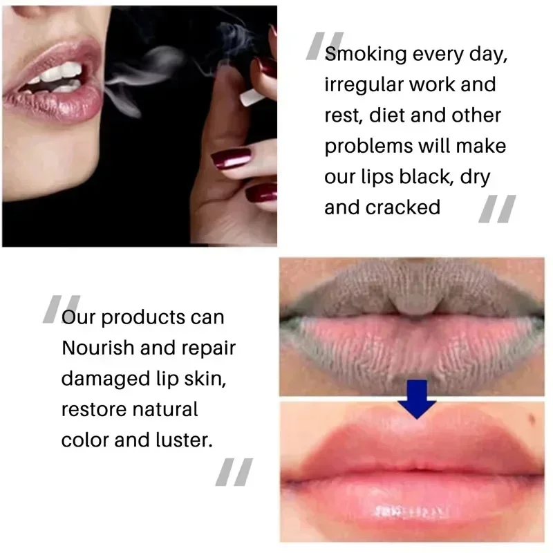Remove Dark Lip Balm Fast Lightening Pink Lip Exfoliating Fade Lip Line Dead Skin Moisturizer Korean Care Products Beauty Health - Image 5