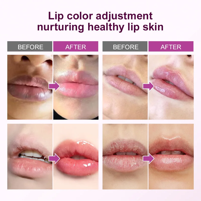 Remove Dark Lip Balm Fast Lightening Pink Lip Exfoliating Fade Lip Line Dead Skin Moisturizer Korean Care Products Beauty Health - Image 2