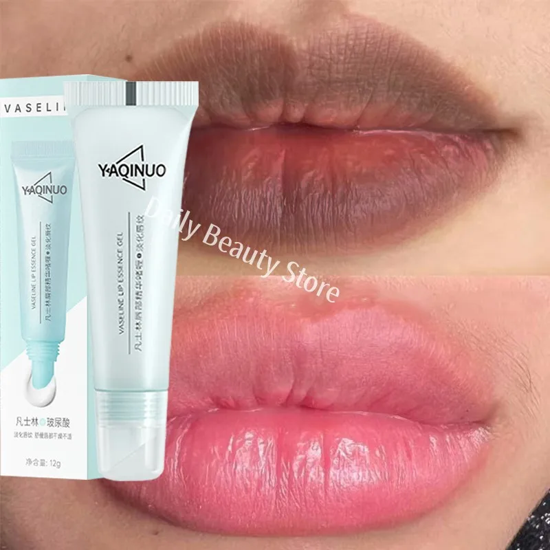 Remove Dark Lip Balm Fast Lightening Pink Lip Exfoliating Fade Lip Line Dead Skin Moisturizer Korean Care Products Beauty Health