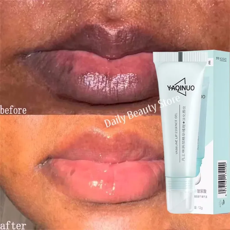 Remove Dark Lip Balm Fast Lightening Pink Lip Exfoliating Fade Lip Line Dead Skin Moisturizer Korean Care Products Beauty Health - Image 9