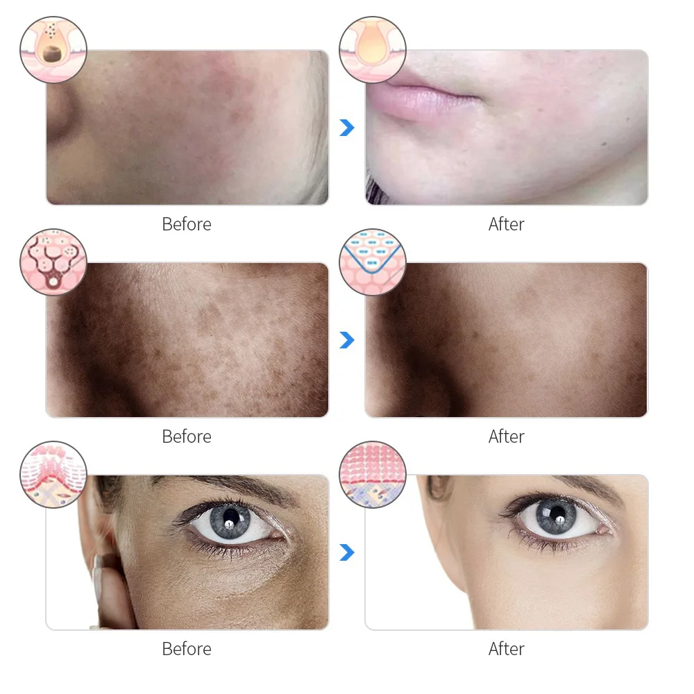 Rechargeable Facial LED Mask 7 Colors LED Photon Beauty Mask Skin Rejuvenation Home Face Lifting Whitening Skin Care Beauty Mask - Image 5