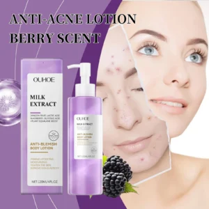 Berry Scented Blemish Lotion Care Facial Moisturizer Reduce Breakouts & Tighten Skin Non-Comedogenic Hydrator Clear Glowing